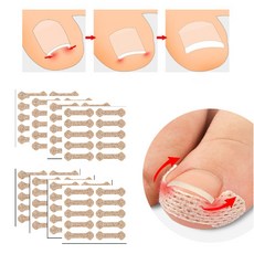 프리클라 발톱 패치 밴드 대용량 80p, 1개