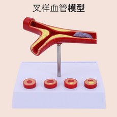 동맥경화혈관모형 해부학 병원 교육용 혈전 모델 고지혈증 인체, A. 갈라진, 1개