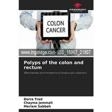 (영문도서)Polyps of the colon and rectum Paperback, Our Knowledge Publishing, English, 9786202940276 Our Knowledge Publishing, English, 9786202940276