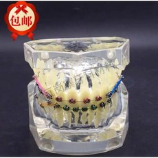치아 충치 구강모형 우식 발달 교육 실습용 교구 이빨 잇몸 해부, 투명하고 깔끔한 올메탈 모델 3005-2