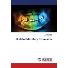 (英文圖書)Skeletal Maxillary Expansion 平裝版, LAP Lambert Academic Publis..., 英文