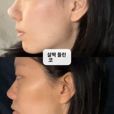 가짜 실리콘코 메이크업 코스프레 코스튬 특수분장, 1개, 작은 돌출 코 4개입 포함