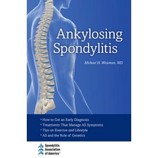 (영문도서) Ankylosing Spondylitis Hardcover, Oxford University Press, USA, English, 9780195399103