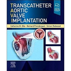 Transcatheter Aortic Valve Implantation, Elsevier