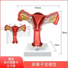 자궁 자궁모형 상담 여성 조산사 교육 부인과 산부인과, A. 난소 자궁 모델