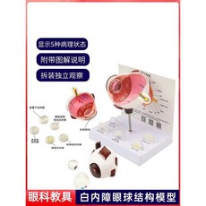 올유원 해부학 안구 6배 확대 얼굴 특징 구조 안과 교육 의료용 과학 수업 의학, Pathological eye