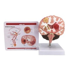 뇌모형 교구 교육용 상품 중추 뇌간 분리 두뇌 뇌구조 해부학 모형 인체 골격 뼈 모델 교육, B. 색분뇌 2 위젯