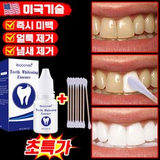 [즉시효과] 셀프 치아미백제 치아케어 치아 화이트닝 페인트 미백 치약 구강 위생 클렌징 플라크 누렁이 얼룩 제거 저자극 포장 증정, 1개, 10ml