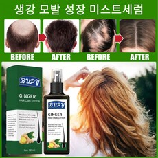 탈모영양제 탈모 예방 탈모 개선 탈모 모발 활력 증진 모낭 보습 성장 촉진미스트세럼, 1개, 120ml