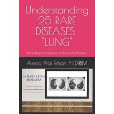 (영문도서) Understanding 25 RARE DISEASES - LUNG: Decoding the Mysteries of Rare Lung Diseases: What You... Paperback, Independently Published, English, 9798874421663