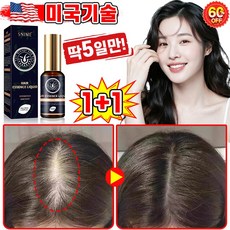 [빠른효과] 미국기술 1/1+1/2+2 두피 영양제 머리 발모제 모발 성장 촉진 에센스 탈모 방지 완화 두피케어 세럼 포장증정, 2개, 30ml