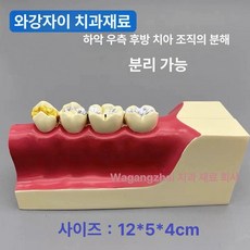 치아 모형 썩은이 실습 충치 교육 치위생 교육용 구강, 오른쪽 하단 치아 분해 모델 m9, 1개, 기본 색상