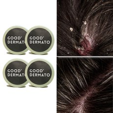 굿더마토 징크피리치온 두피샴푸바 115g (비듬각질가려움 싹! 피지냄새까지 씻어서 박멸해~ 지성두피 샴푸바 천연비누 수제비누 샴푸바 두피스케일링 모낭 모근), 4개