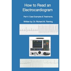 How to Read an Electrocardiogram - Part 4: Case Examples & Treatments. Paperback, Independently Published, English, 9798571020725