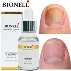 비오틴 약모밀 병풀추출물 단백질함유 손발톱 리페어 에센스, 1개, 18ml