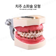 치위생가 연습용 치과 포함 이중용 수지치아 마네킹 교육용 모형, B. 치주 스크래치 다이