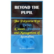 (영문도서)Beyond the Pupil: The Polycoria Eye Defect (Causes Treatment and Management of... Paperback, Independently Published, English, 9798299451214