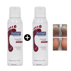 1+1 Footlogix 풋로직스 러프 스킨 포뮬라 119.9g (2개), 1개입