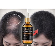 헤어에센스추천 탈모영양제 여성탈모 헤어에센스오일 폴리쉬 오일 두피앰플 컬링에센스 원형탈모 성장 모발 활력 증진 두피영양제 눈썹영양제 블랙속눈썹영양제 수염발모제, 2개, 30ml