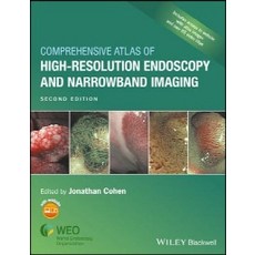 Comprehensive Atlas of High-Resolution Endoscopy and Narrowband Imaging 2/e, Wiley-Blackwell