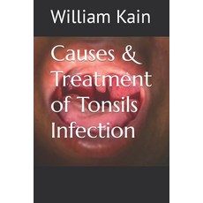 (영문도서) Causes & Treatment of Tonsils Infection Paperback, Independently Published, English, 9798389983694