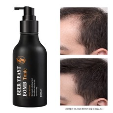 맥주효모 두피 탈모 케어 영양 헤어토닉 부스터 두피 에센스 토닉 앰플 탈모증상완화, 1개, 100ml