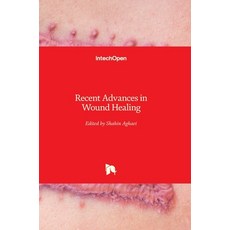 (영문도서) Recent Advances in Wound Healing Hardcover, Intechopen, English, 9781839685729