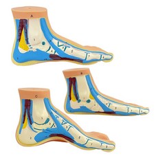 정상 평발 아치형 발 모델 발궁 해부 학습용 교육용 발 모형 G_발해부세트-3개-각인, 3개