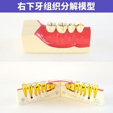 치아 모형 치과 상담 교구 덴티폼, 조직 분해 모델