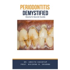 (영문도서) Periodontitis Demystified: Doctor's Secret Guide Paperback, Virtued Press, English, 9798223858218