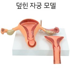 여성 생식 자궁 모델 난소 회음부 병리학적 변화골반 시상, C. 정상 자궁(덮음)