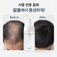 스칼프 부스팅 두피 탈모 앰플 부스팅 앰플 카페인 헤어 인핸싱 폼 두피 모발 헤어 토닉 앰플 영양제 탈모 헤어토닉 두피 앰플, 1개, 110ml