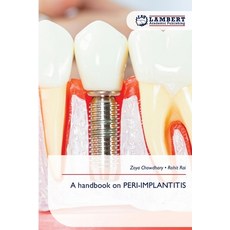 (英文圖書)A handbook on PERI-IMPLANTITIS 平裝版, LAP Lambert Academic Publis..., 英文
