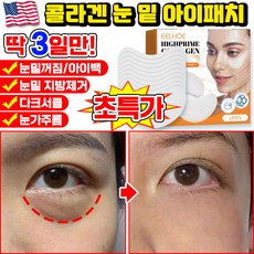 [당일출고] 미국기술 10/10+10/20+20 콜라겐 아이패치 눈밑 지방제거 패치 다크서클 눈밑꺼짐 제거 아이팩 눈가주름 패치 아이백 리프팅 아이케어 사은품 랜덤 증정, 1개, 10개입