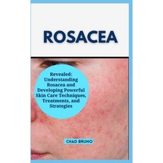 (영문도서) Rosacea: Revealed: Understanding Rosacea and Developing Powerful Skin Care Techniques Treatm... Paperback, Independently Published, English, 9798878511322