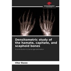 (영문도서)Densitometric study of the hamate capitate and scaphoid bones Paperback, Our Knowledge Publishing, English, 9786206813453