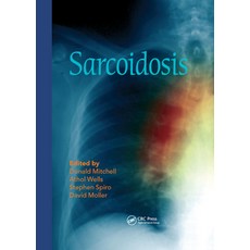 (영문도서)Sarcoidosis Paperback, CRC Press, English, 9780367576769 CRC Press, English, 9780367576769