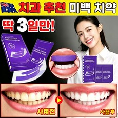슈퍼인 V34 퍼플 치아미백테이프 컬러보정 구강케어 14회분, 14세트