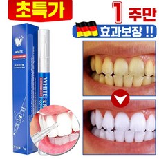 1/1+1 화이트닝 셀프 치아 치아미백 펜 겔 구강 위생 입냄새 누렁니 얼룩 제거, 1개, 3g