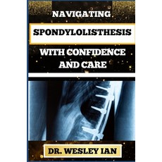 (영문도서) Navigating Spondylolisthesis with Confidence and Care: Empower Yourself With In-Depth Insight... Paperback, Independently Published, English, 9798876864642