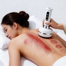 자동 제습 30단 조절 진공 흡입력 다기능 부항 괄사 마사지기, 흰색, 1세트