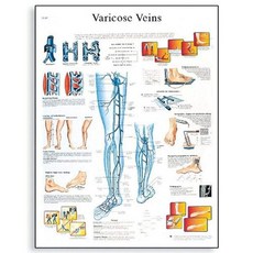 3B Scientific VR1367L 광택 라미네이트 종이 정맥류 해부도 포스터 크기 20 너비 x 26 높이
