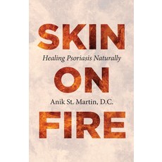 (英文圖書)Skin on Fire: Healing Psoriasis Naturally 平裝版, Anik St. Martin Books, 英文, 平裝本