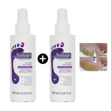1+1 Footlogix 풋로직스 캘러스 소프트너 180ml (2개), 1개입