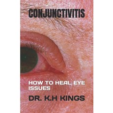 (영문도서) Conjunctivitis: How to Heal Eye Issues Paperback, Independently Published, English, 9798399252872
