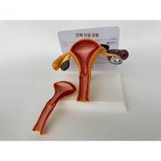 여성 자궁 모형 병리학 교육용 모델 생식기관 골격 건강한 분만 표본 해부학, A. 뚜껑이 있는 건강한 자궁