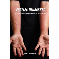 (영문도서)Eczema unmasked: A guide to managing atopic dermatitis Paperback, Independently Published, English, 9798288174797