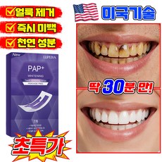 [즉시 미백] V34 치아미백 테이프 치아 보색 테이프 치아미백 패치 치아미백제 미백 스트랩 누렁니 얼룩 제거 포장 증정 SUOSER, 1개