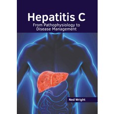 Hepatitis C: From Pathophysiology to Disease Management Hardcover, Hayle Medical