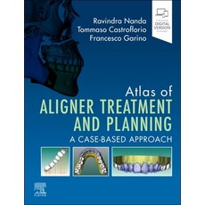 (영문도서)Atlas of Aligner Treatment and Planning: A Case-Based Approach Hardcover, Elsevier, English, 9780443116087